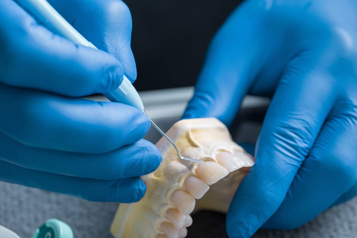 A person working on a mold which will be used for dental restoration treatment